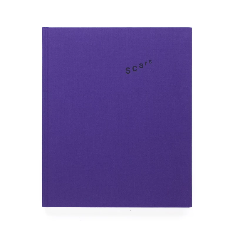 scars 写真集 blackeyepatch BlackEyePatch が小浪次郎との新