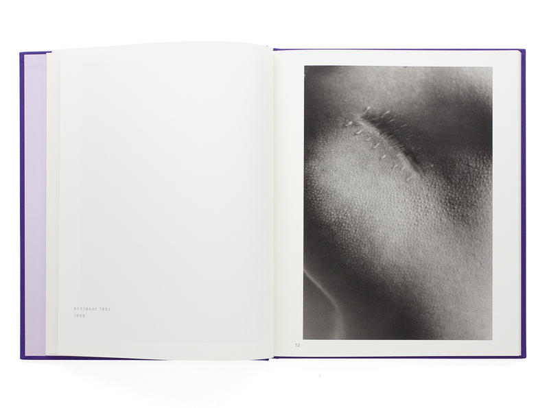 Scars - Miyako ISHIUCHI | shashasha - Photography & art in books