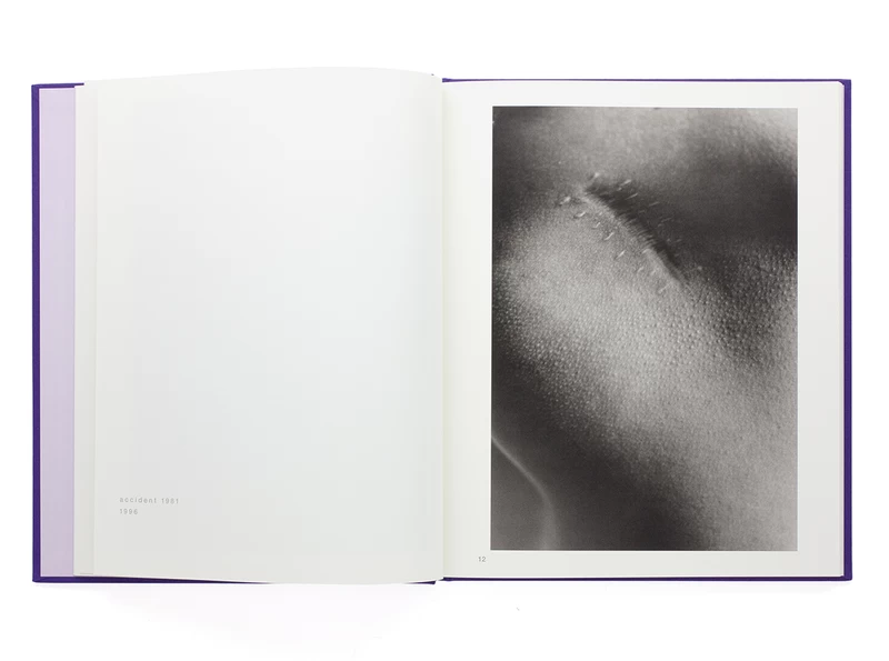 Scars - ISHIUCHI Miyako | shashasha - Photography & art in books